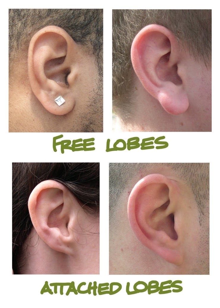  chin lbobes ear 